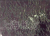 镜片表面的霉菌