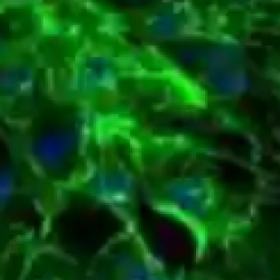 借助显微镜开展神经科学研究：神经元结构与突触连接观测方法