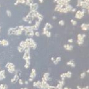 生物样本观测难题解决：显微镜高倍成像模糊、反光问题处理方案
