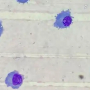 高端生物显微镜对比：普通款与共聚焦机型在科研中的优劣分析