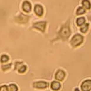 生物制剂质检：显微镜排查原液中杂质与异常微生物污染物