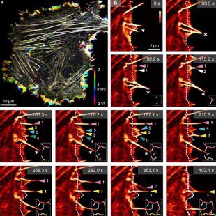 Nature Photonics 重磅：中国团队研发数字阵列调制显微镜，超分辨率