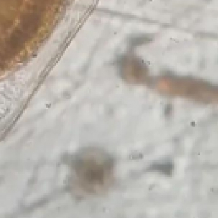 水质监测新方法：生物显微镜计数浮游生物评估水体健康
