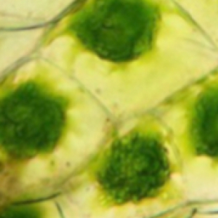 污水处理优化：生物显微镜监控微生物活性提升处理效率