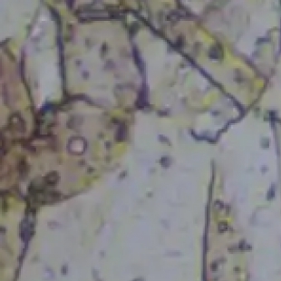 相差显微镜原理解析：如何让透明无色的生物样本清晰可见