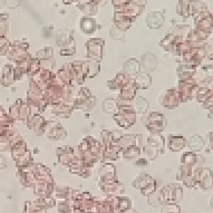 细菌形态观察显微镜选购指南，微生物实验室必备的高性价比型号