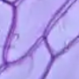 共聚焦显微镜的功能特点：在生命科学研究中的突破性应用