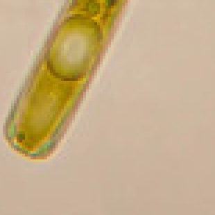 生物显微镜使用安全：生物样本处理与消毒的注意事项
