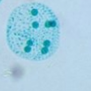 荧光显微镜怎么挑？生命科学场景下这5个参数决定成败