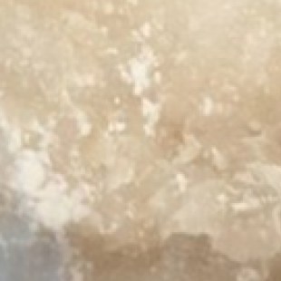 显微镜工作距离详解：物镜与样本之间的关键距离