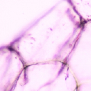 微生物镜检制样误差分析与标准化操作指南